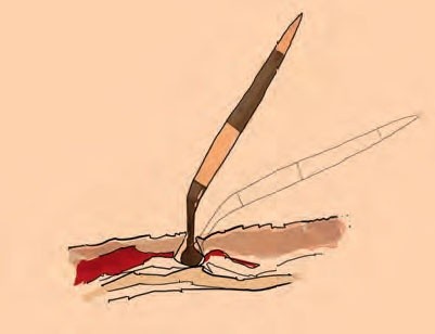 Illustration des Aufbaus eines Igelstachels